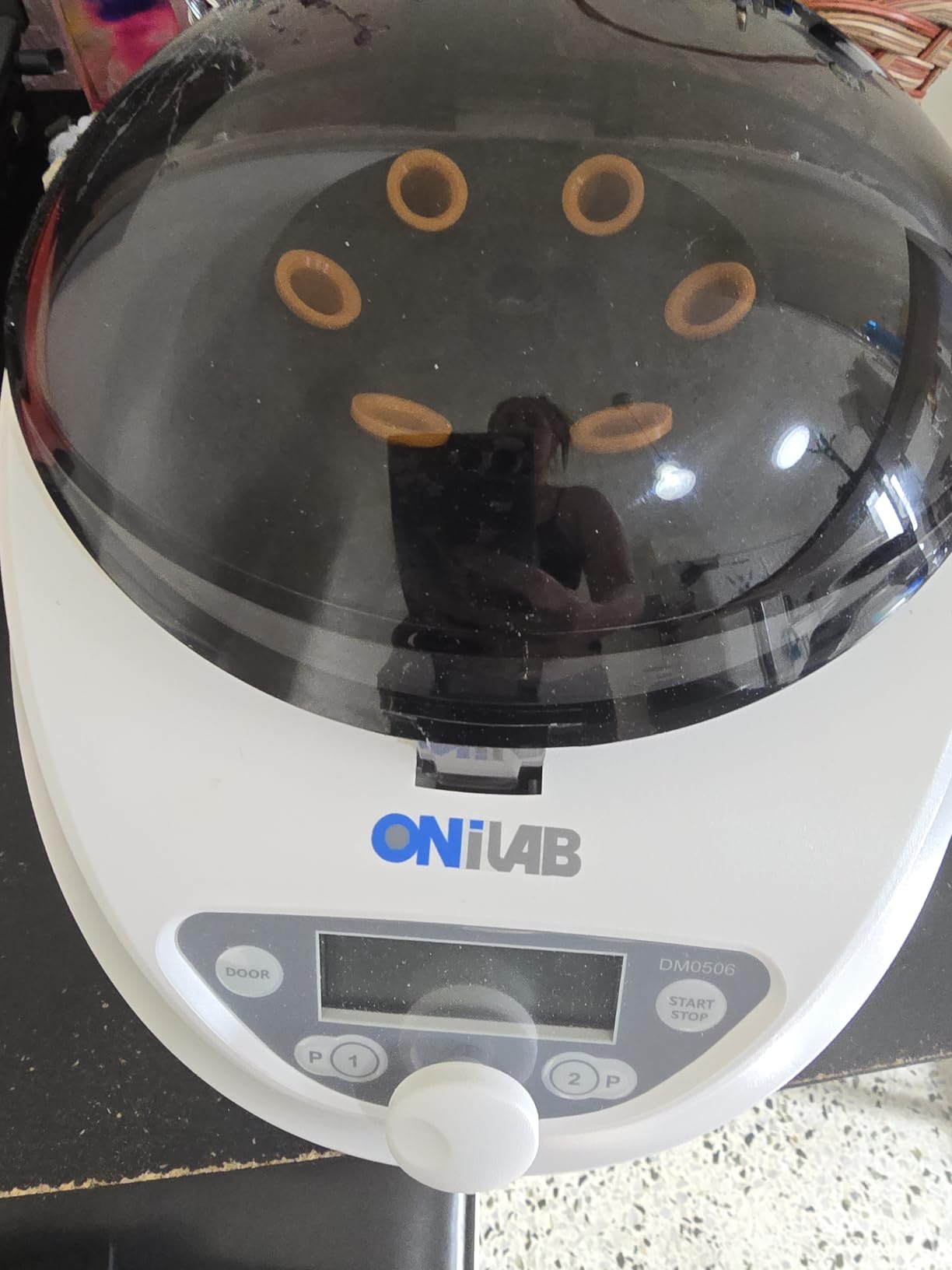 ONiLAB Lab PRP Benchtop Centrifuge 6x15mL/10mL/7mL/1.5-5ml, 300-5000rpm (Max. 2600xg RCF), LCD Digital Desktop Lab Centrifuge Timer 30sec-99min, Two Quick Start Programs customer photo 1