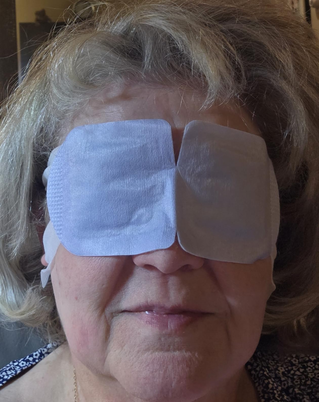 CorneaCare Rest Self Heating Warm Compress | Heated Eye Mask for Fast Relief | Steam Mask for Stye Treatment | No Microwave or Washcloth Needed | Travel Ready Warm Compress | 30 Count customer photo 2
