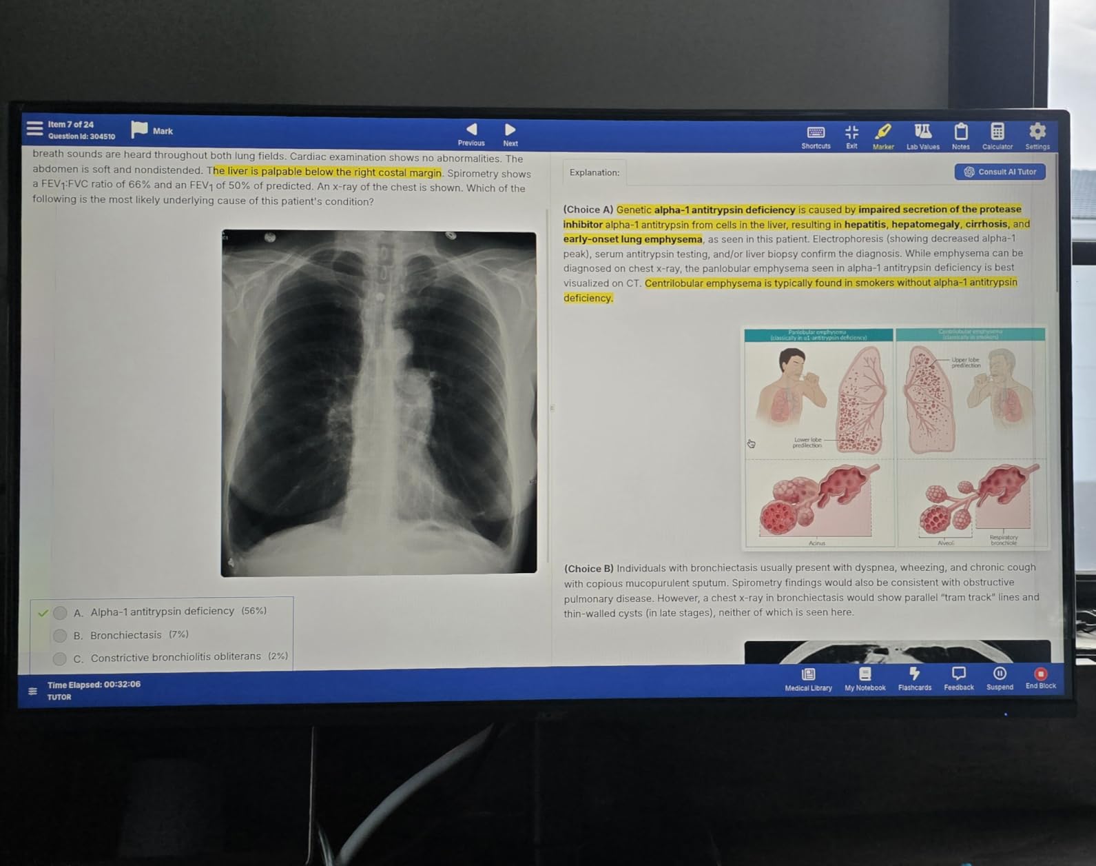 Acer 27in FHD 1920x1080 IPS 120Hz Gaming Monitor | Office KB272 G0bi | 1ms, AdaptiveSync, sRGB 99%, HDMI, VGA, VESA Mountable, Bluelight Filter customer photo 1