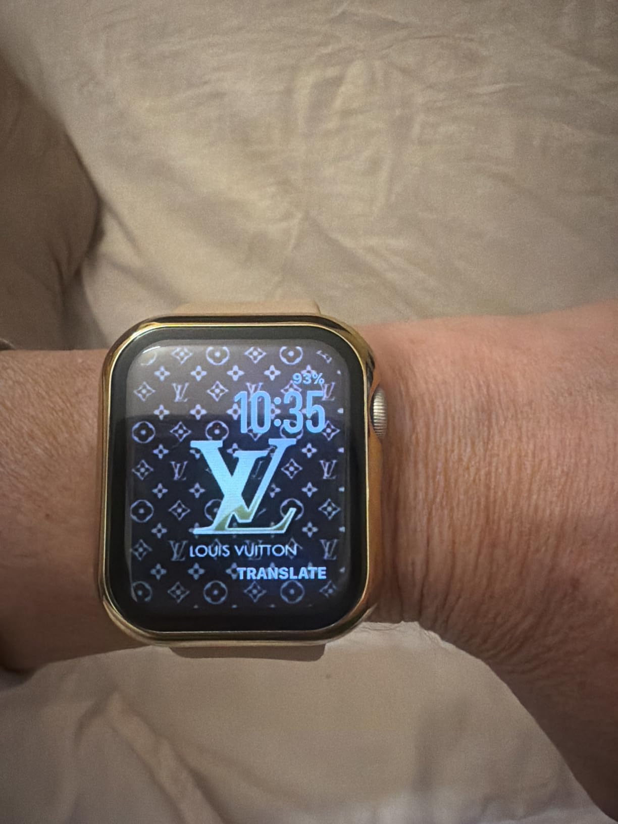 Apple Watch SE 3 [GPS 40mm] Smartwatch with Starlight Aluminum Case with Starlight Sport Band - S/M. Fitness and Sleep Trackers, Heart Rate Monitor, Always-On Display, Water Resistant customer photo 1