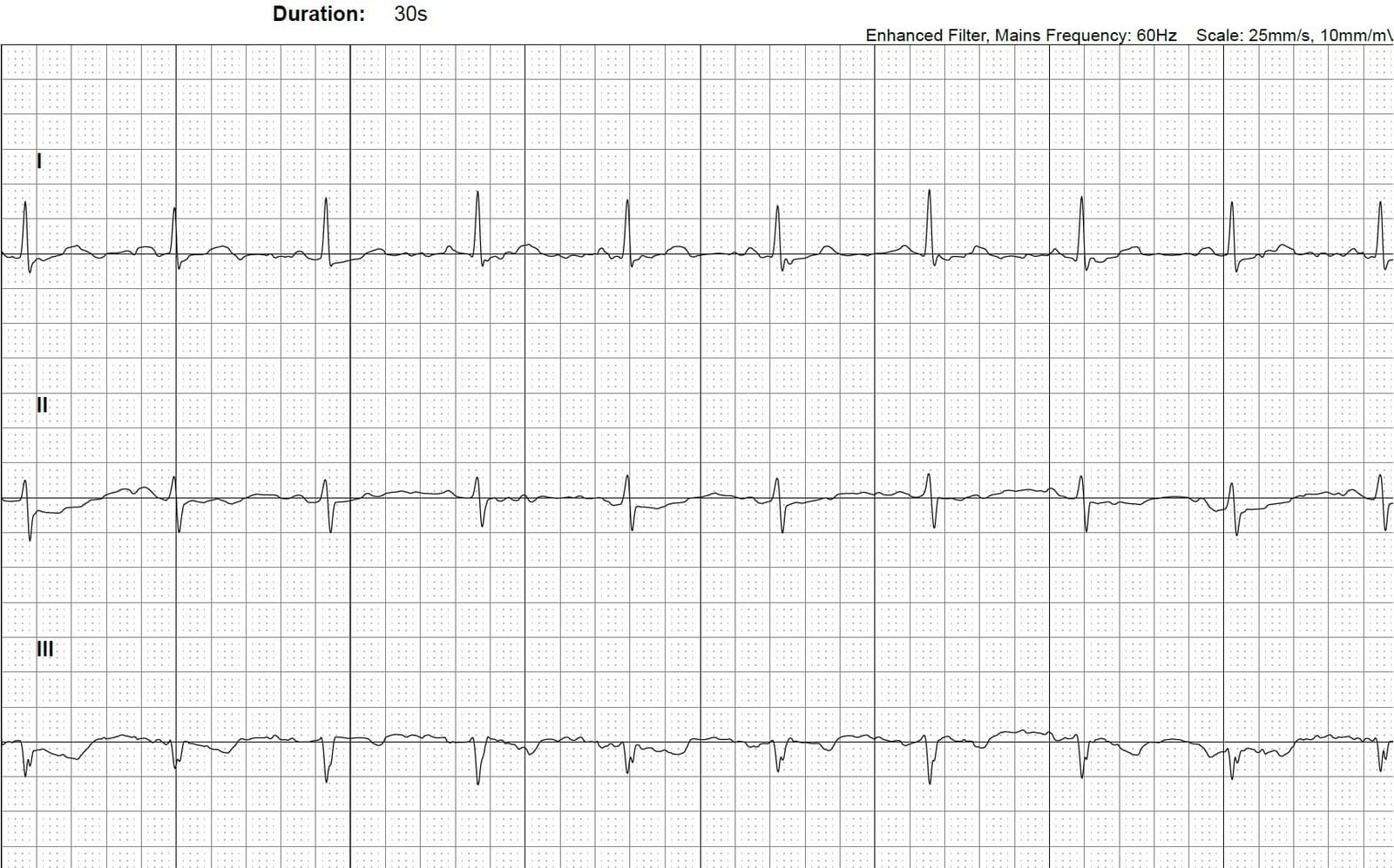 KardiaMobile 6L EKG, No Membership Required, Unlimited Recordings, HSA/FSA | Detects 4 Arrhythmias, FDA-Cleared Heart Monitor, Medical-Grade Results in 30 Seconds, Works with Smartphones and Tablets customer photo 2