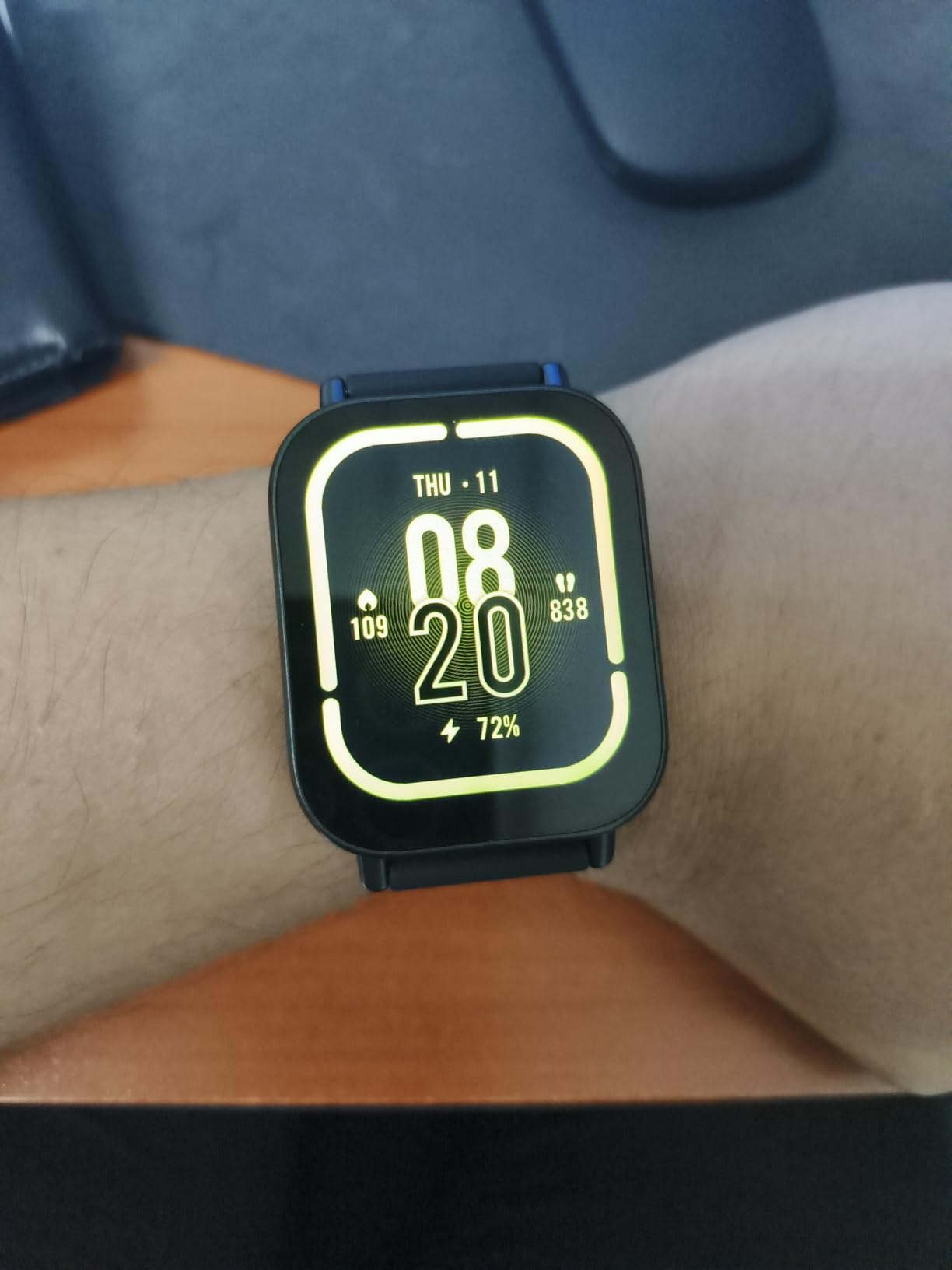 XIAOMI Redmi Watch 5 Active Midnight Black customer photo 2