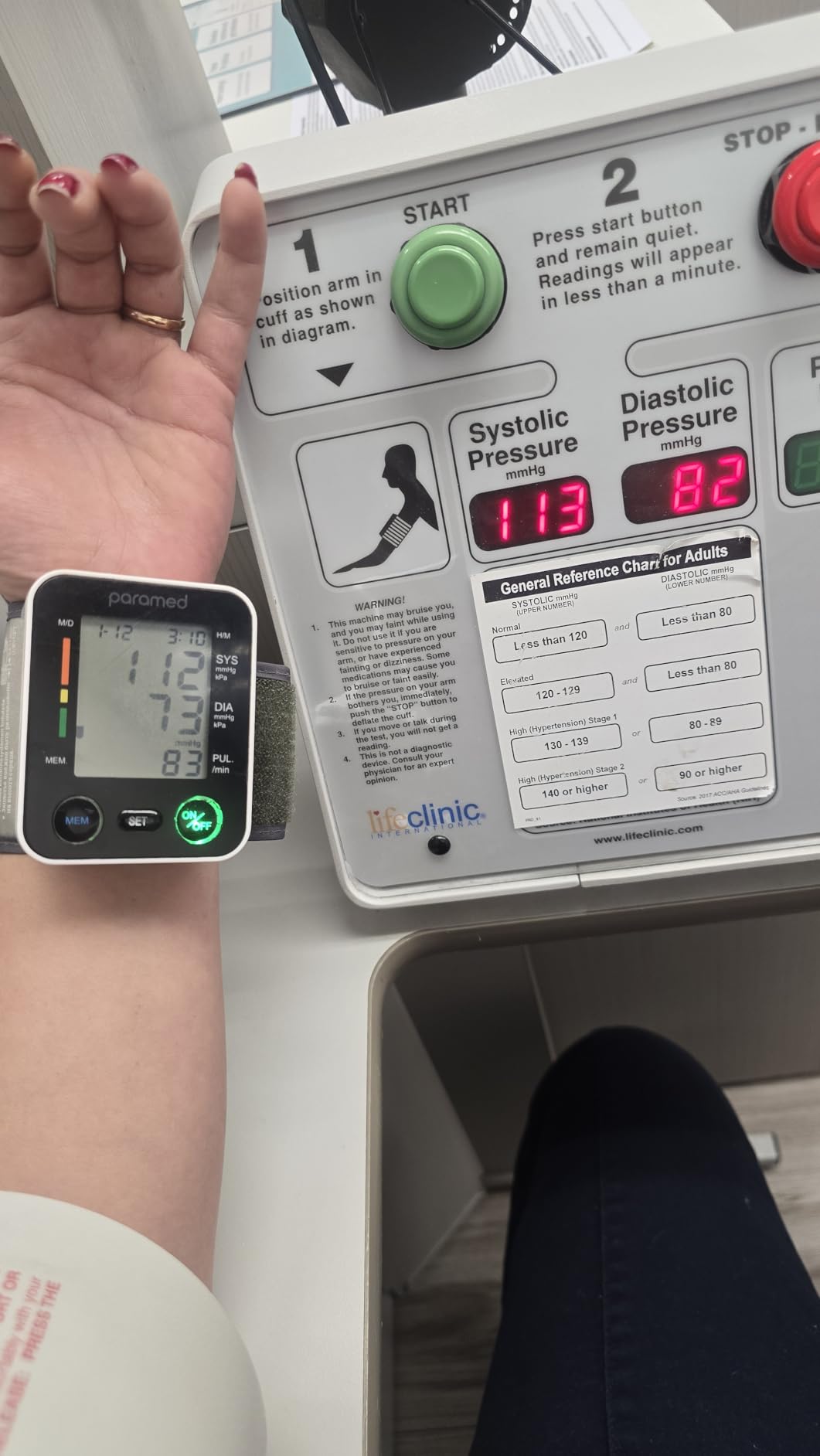 PARAMED Automatic Wrist Blood Pressure Monitor: Blood-Pressure Kit of Bp Cuff + 2AAA and Carrying case - Irregular Heartbeat Detector & 90 Readings Memory Function & Large Display customer photo 1