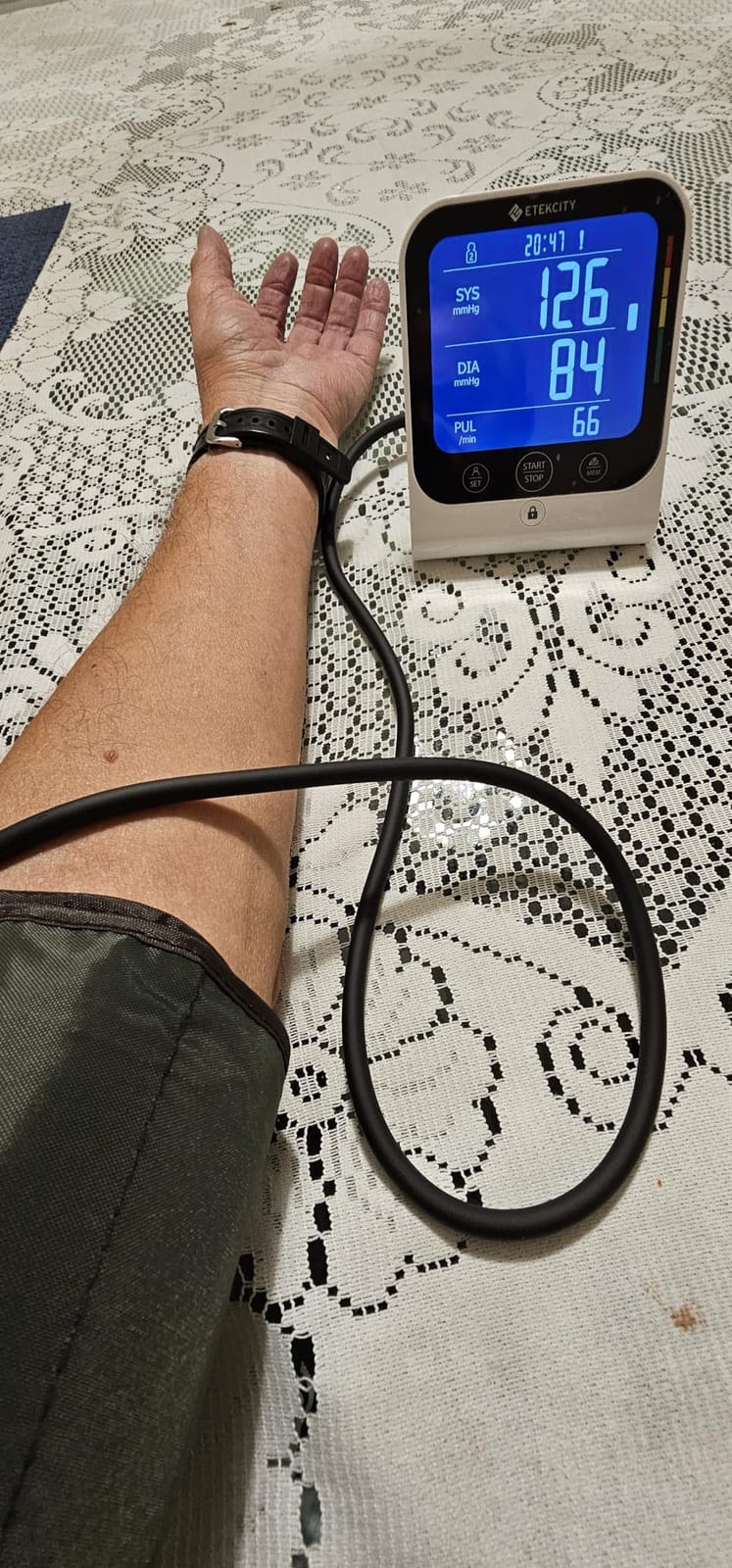 Etekcity Bluetooth Blood Pressure Monitor for Home Use, Upper Arm, FSA customer photo 1